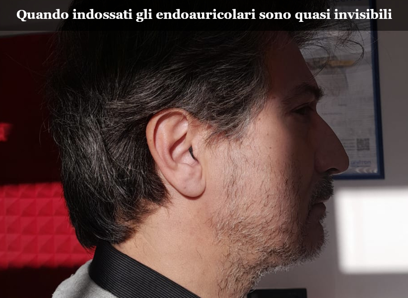 Apparecchi acustici endoauricolari quasi invisibili